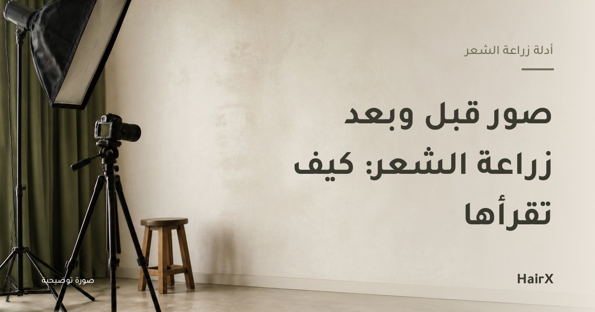 صورة توضيحية: كاميرا على حامل أمام حائط مضاء بانتظام — كيف تقرأ صور قبل وبعد